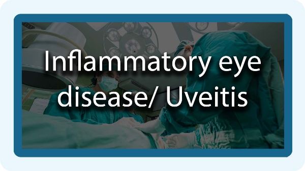 inflammatory eye disease